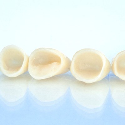 Multiple dental crowns lined up in a row